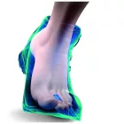 Sidas Gel Toe Wrap Silitene™ mosható zselés lábujjvédő